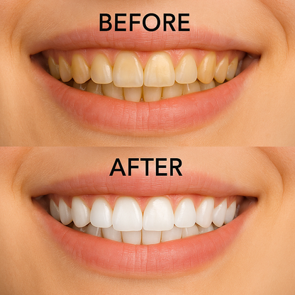 Glow Smile Pro